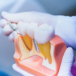 Dentist in Covington LA