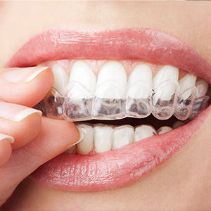 Family Dentist in Covington LA