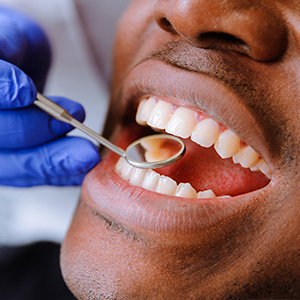 Dental Office in Covington LA